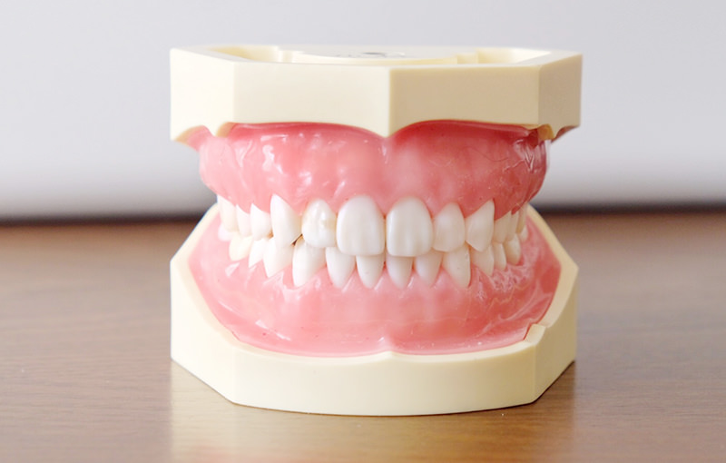歯茎を健康的なピンク色に